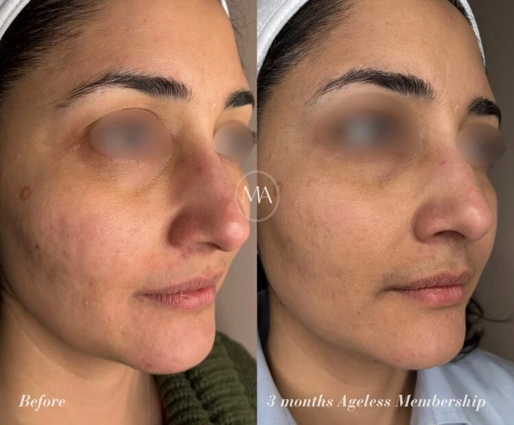 Before and After Ageless Membership