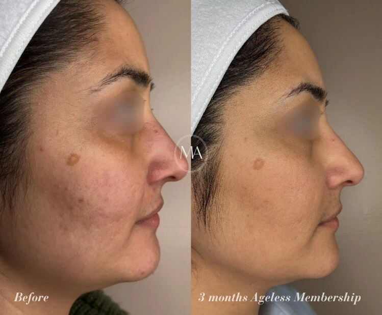 Before and After Ageless Membership