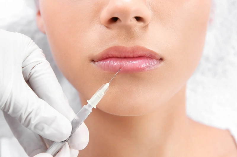 Lip Filler in Buffalo, NY
